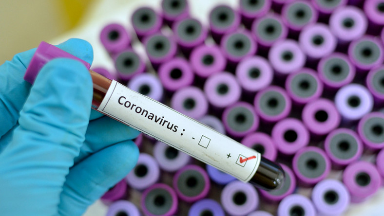 Breaking! Nigeria records 14 new cases of #Coronavirus, total cases now 65!