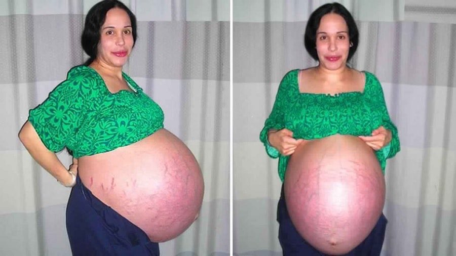 8 years later, see pictures of woman who gave birth to 8 kids and the children 1