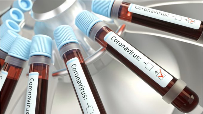 Breaking! Nigeria’s Coronavirus tolls exceeds 9000 with 387 new cases! See details here 👇
