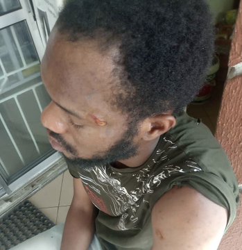 Man recounts how he survived multiple knife attacks by armed robbers just two weeks to his Traditional Marriage! (See pictures)