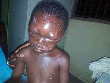 Shocking! Seven-year-old boy beaten mercilessly by his step-father for eating the rice and beans meant for Supper! (Pictures)