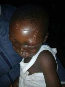 Shocking! Seven-year-old boy beaten mercilessly by his step-father for eating the rice and beans meant for Supper! (Pictures) 1