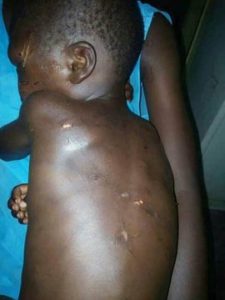 Shocking! Seven-year-old boy beaten mercilessly by his step-father for eating the rice and beans meant for Supper! (Pictures) 2