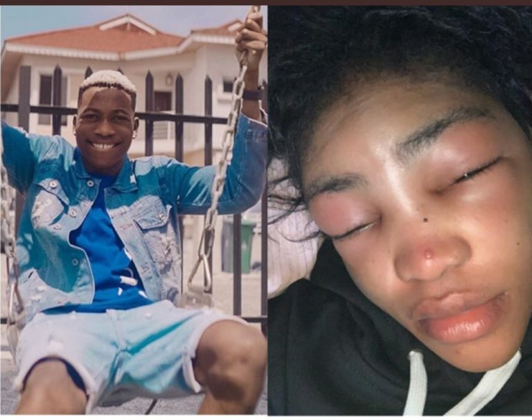 Outrage as Twitter users call out Davido’s artiste, Lil Frosh for allegedly beating his girlfriend to pulp! Pictures 👇