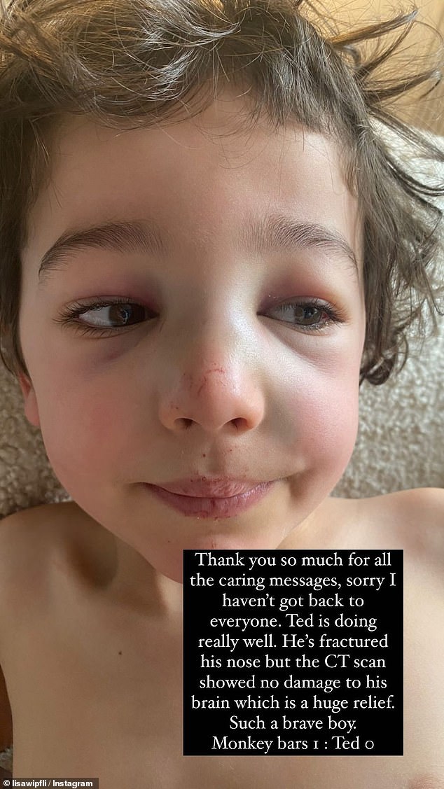 Michael ‘Wippa’ Wipfli’s son Ted fractures his nose during a playground mishap