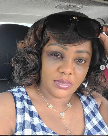 Nollywood actress Helen Paul reveals she was involved in an accident