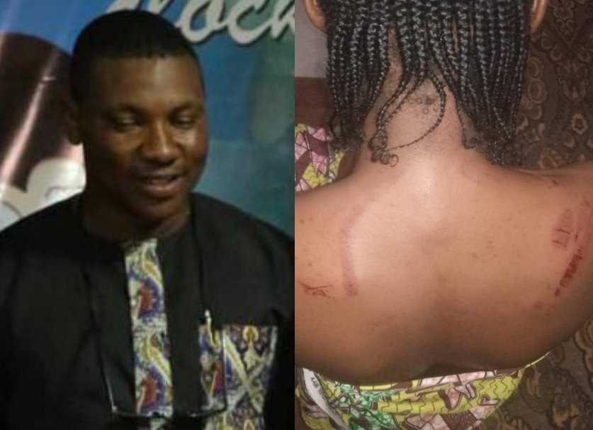 Civil Defence Officer Tortures, Brutalises Sister In Abuja For Allegedly Having Boyfriend