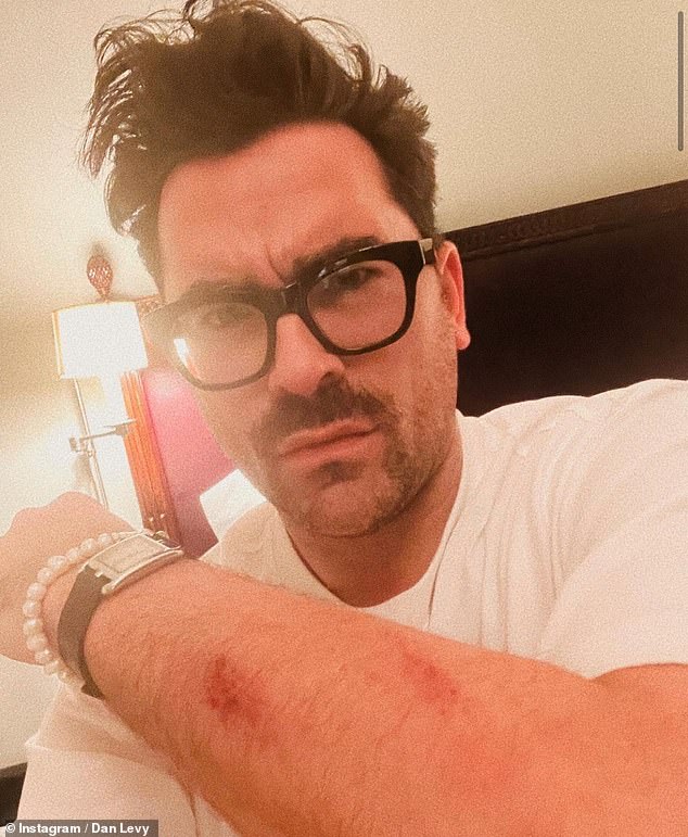 Schitt’s Creek’s Dan Levy suffers nasty cuts on after falling over running to the toilet