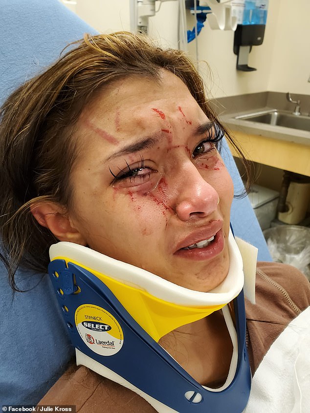 Texas girl, 17, was beaten up while being filmed on Snapchat by her best friend and her pal