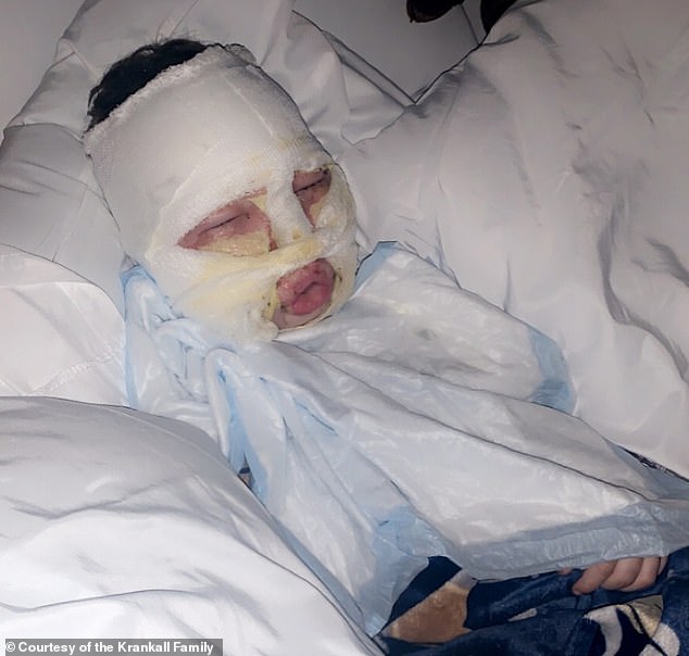 Boy, 6, with burns after lit tennis ball thrown at his face ‘terrorized’ by bully, 8